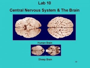4th ventricle sheep brain