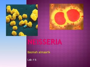 NEISSERIA Basmah almaarik Lab 6 Contains many species
