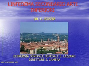 LINFEDEMA SECONDARIO ARTI INFERIORI DR C IOZZIA CHIRURGIA