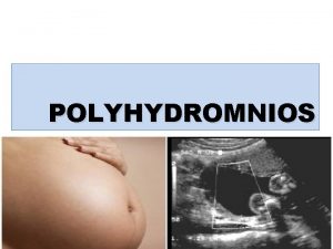 Causes of polyhydramnios