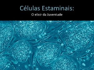 Clulas Estaminais O elixir da Juventude O que