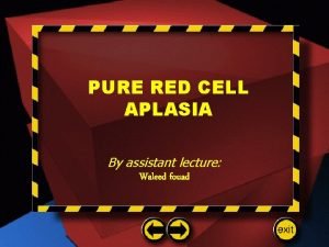 PURE RED CELL APLASIA By assistant lecture Waleed