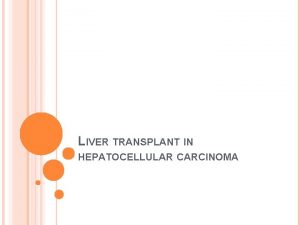 LIVER TRANSPLANT IN HEPATOCELLULAR CARCINOMA OUTLINE Indications Milan