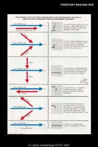 PODSTAWY BADANIA EKG Do uytku wewntrznego KNTi D