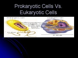 Prokaryotic Cells Vs Eukaryotic Cells Now that we
