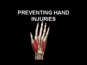Preventing hand injuries