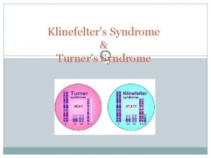 Kleinfelters syndrome