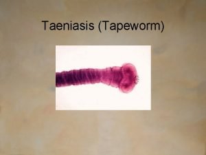 Taeniasis Tapeworm Micoororganism nameType Taenia Saginata T saginata