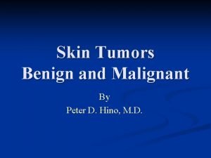 Malignant and benign tumors