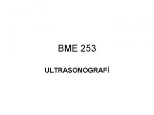 BME 253 ULTRASONOGRAF ULTRASONOGRAF ULTRASONOGRAFNN TEMEL FZK PRENSPLER