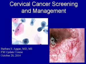 Cervical Cancer Screening and Management Barbara S Apgar