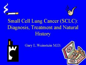 Small Cell Lung Cancer SCLC Diagnosis Treatment and