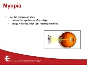 Myopia How the human eye sees Lens of