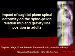 Impact of sagittal plane spinal deformity on the