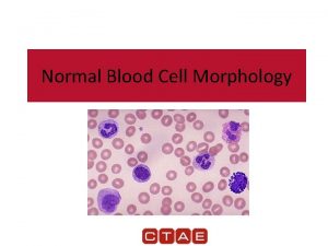 Normal Blood Cell Morphology Types of White Blood