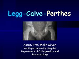 LeggCalvePerthes Assoc Prof Melih Gven Yeditepe University Hospital