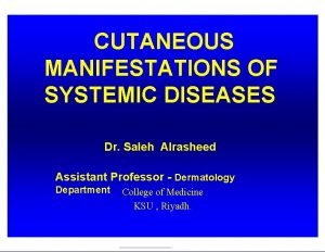 CUTANEOUS MANIFESTATIONS OF SYSTEMIC DISEASES Dr Saleh Alrasheed