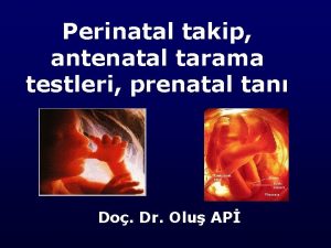 Perinatal takip antenatal tarama testleri prenatal tan Do