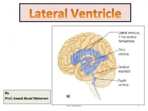 Third ventricle