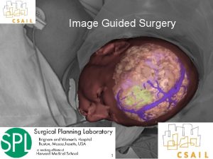 Image Guided Surgery 1 Conventional Surgery Seeing surfaces