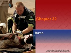 Chapter 32 Burns National EMS Education Standard Competencies