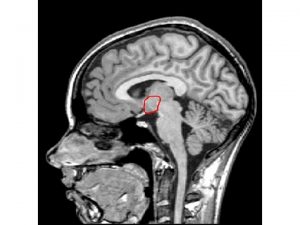 Afferents Somatic Visceral Visual Olfaction Auditory Corticohypothalamic Hippocampohypothalamic
