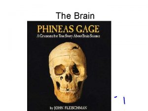 Part of brain for hunger Part of brain for hunger