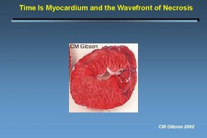 Time Is Myocardium and the Wavefront of Necrosis