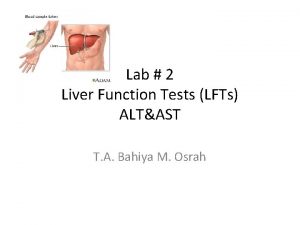 Lab 2 Liver Function Tests LFTs ALTAST T