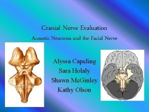 Cranial Nerve Evaluation Acoustic Neuroma and the Facial