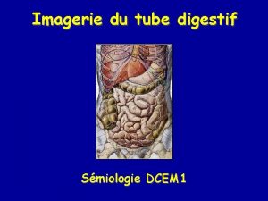 Imagerie du tube digestif Smiologie DCEM 1 Imagerie