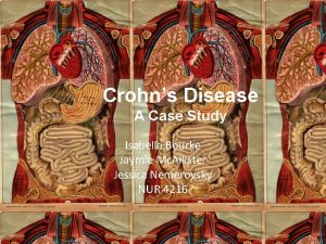 Crohns Disease A Case Study Isabella Bourke Jaymie