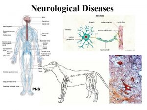 Neurological Diseases PNS Nervous System CNS Brain spinal