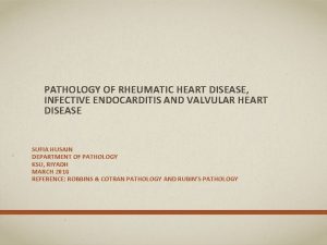 Vegetations in infective endocarditis