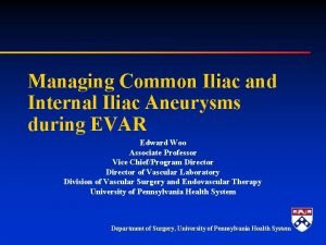 Managing Common Iliac and Internal Iliac Aneurysms during