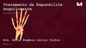 Tratamento da Espondilite Anquilosante Reumatologia Dra Maria Eugnia