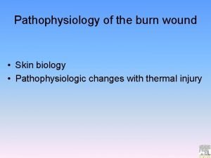 Pathophysiology of the burn wound Skin biology Pathophysiologic