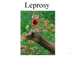 Defination of leprosy