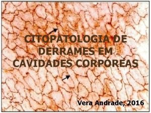 CITOPATOLOGIA DE DERRAMES EM CAVIDADES CORPREAS Vera Andrade