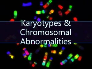 Karyotypes Chromosomal Abnormalities Karyotyping A Karyotype is a