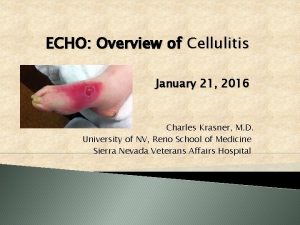 ECHO Overview of Cellulitis January 21 2016 Charles