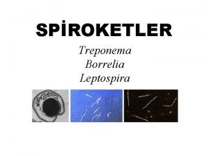 SPROKETLER Treponema Borrelia Leptospira GENEL ZELLKLER Spiral sarmalhelikal