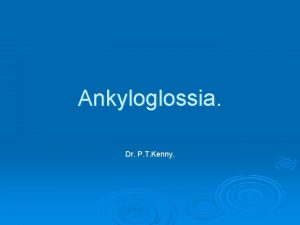 Ankyloglossia Dr P T Kenny See Frenotomy in