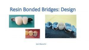 Resin bonded bridge design