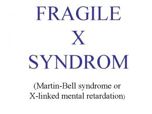 FRAGILE X SYNDROM MartinBell syndrome or Xlinked mental