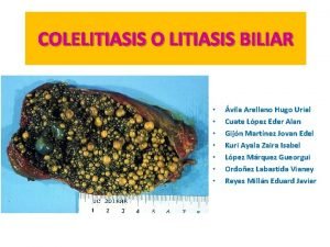 Coelitiasis