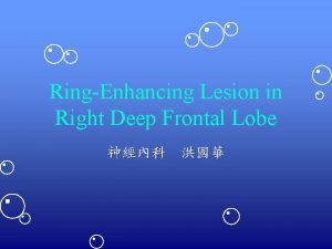 RingEnhancing Lesion in Right Deep Frontal Lobe Clinical