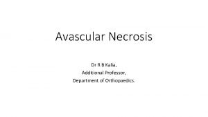 Avascular Necrosis Dr R B Kalia Additional Professor