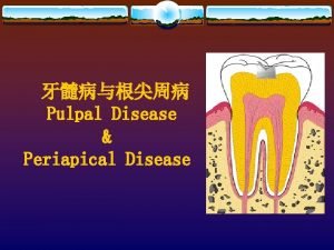 Periapical Periapical