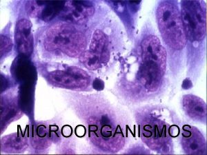 MICROORGANISMOS MICROORGANISMOS Un microorganismo tambin llamado microbio u